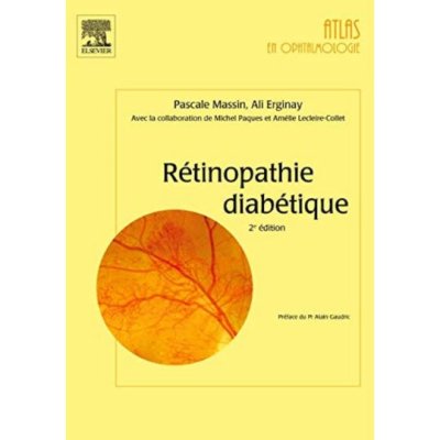Rétinopathie diabétique de Pascale Massin et Ali Erginay